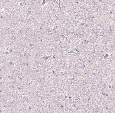 Immunohistochemistry-Paraffin: Uroplakin II Antibody [NBP2-38904]