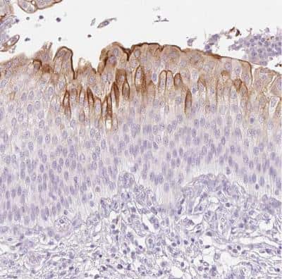 Immunohistochemistry-Paraffin: Uroplakin II Antibody [NBP2-38904]
