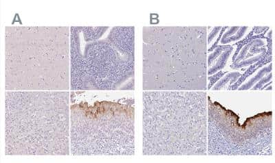 Immunohistochemistry-Paraffin: Uroplakin II Antibody [NBP2-38904]