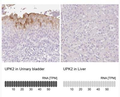 Immunohistochemistry-Paraffin: Uroplakin II Antibody [NBP2-38904]