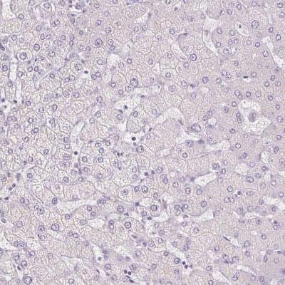 Immunohistochemistry-Paraffin: Uroplakin II Antibody [NBP2-38904]