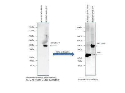 Western Blot: Uroplakin II Antibody [NBP2-38904]