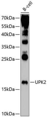 Western Blot: Uroplakin II AntibodyAzide and BSA Free [NBP2-94296]