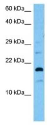 Western Blot: Uroplakin II Antibody [NBP3-10138]