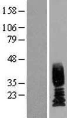 Western Blot: Uroplakin II Overexpression Lysate [NBP2-10399]