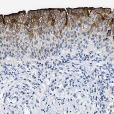 Immunohistochemistry-Paraffin: Uroplakin III Antibody [NBP1-86873]