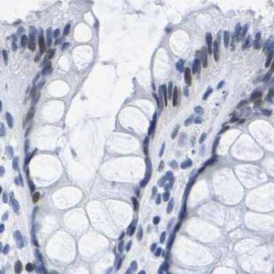 Immunohistochemistry-Paraffin: Uroplakin III Antibody [NBP1-86873]