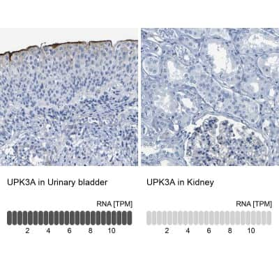 Immunohistochemistry-Paraffin: Uroplakin III Antibody [NBP1-86874]