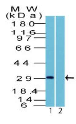 Western Blot: Uroplakin III Antibody [NBP2-29477]