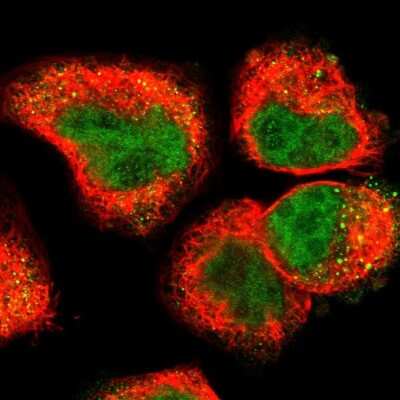 Immunocytochemistry/ Immunofluorescence: Uroplakin IIIB Antibody [NBP1-92564]