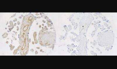 Immunohistochemistry: Uroplakin IIIB Antibody [NBP1-92564]