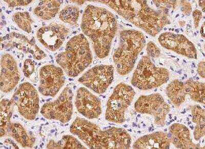 Immunohistochemistry-Paraffin: Uroplakin IIIB Antibody [NBP3-06026]