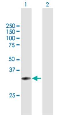 Western Blot: Uroplakin IIIB Antibody [H00080761-B01P]