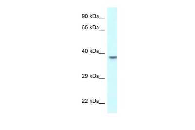 Western Blot: Uroplakin IIIB Antibody [NBP2-86046]