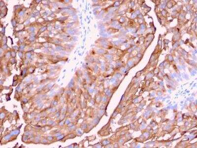 Immunohistochemistry-Paraffin: Uroplakin Ia Antibody (UPK1A/2921) - Azide and BSA Free [NBP2-79868]
