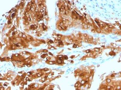 Immunohistochemistry-Paraffin: Uroplakin Ia Antibody (UPK1A/2921) - Azide and BSA Free [NBP2-79868]