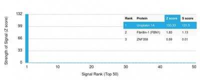 Protein Array: Uroplakin Ia Antibody (UPK1A/2921)Azide and BSA Free [NBP2-79868]