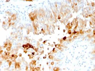 Immunohistochemistry-Paraffin: Uroplakin Ia Antibody (UPK1A/2921) [NBP2-79733]