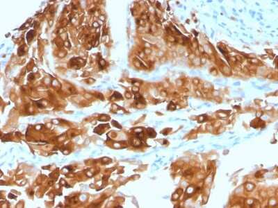Immunohistochemistry-Paraffin: Uroplakin Ia Antibody (UPK1A/2921) [NBP2-79733]