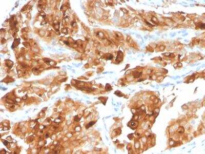 Immunohistochemistry-Paraffin: Uroplakin Ia Antibody (UPK1A/2922) - Azide and BSA Free [NBP2-79869]