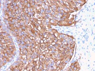 Immunohistochemistry-Paraffin: Uroplakin Ia Antibody (UPK1A/2922) - Azide and BSA Free [NBP2-79869]