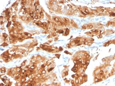 Immunohistochemistry-Paraffin: Uroplakin Ia Antibody (UPK1A/2922) [NBP2-79734]