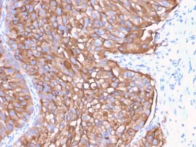 Immunohistochemistry-Paraffin: Uroplakin Ia Antibody (UPK1A/2922) [NBP2-79734]