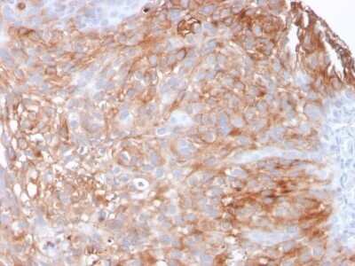 Immunohistochemistry-Paraffin: Uroplakin Ia Antibody (UPK1A/2925) - Azide and BSA Free [NBP2-79870]