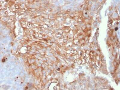 Immunohistochemistry-Paraffin: Uroplakin Ia Antibody (UPK1A/2925) - Azide and BSA Free [NBP2-79870]