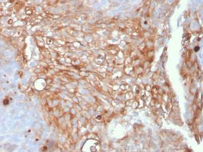 Immunohistochemistry-Paraffin: Uroplakin Ia Antibody (UPK1A/2925) [NBP2-79735]