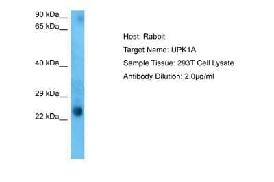 Western Blot: Uroplakin Ia Antibody [NBP2-83743]