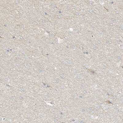 Immunohistochemistry-Paraffin: Uroplakin Ib Antibody [NBP1-80657]