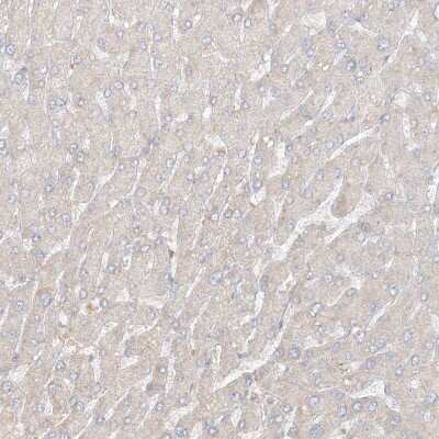 Immunohistochemistry-Paraffin: Uroplakin Ib Antibody [NBP1-80657]