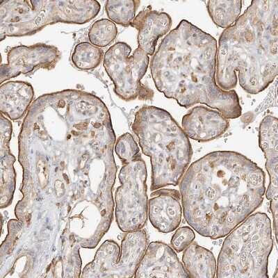 Immunohistochemistry-Paraffin: Uroplakin Ib Antibody [NBP1-80657]