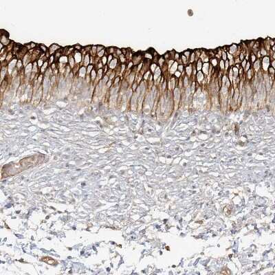 Immunohistochemistry-Paraffin: Uroplakin Ib Antibody [NBP1-80657]