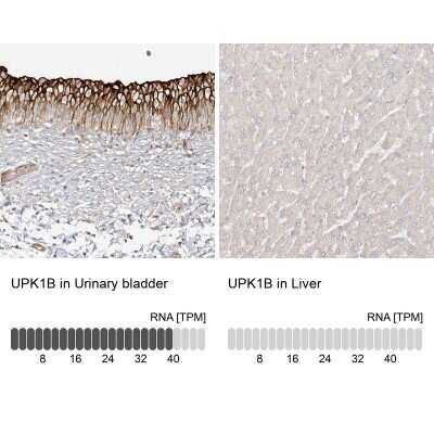 Immunohistochemistry-Paraffin: Uroplakin Ib Antibody [NBP1-80657]