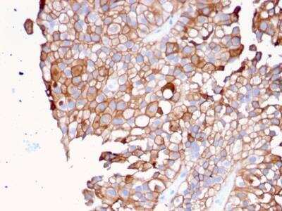 Immunohistochemistry-Paraffin: Uroplakin Ib Antibody (UPK1B/3081) - Azide and BSA Free [NBP2-79933]