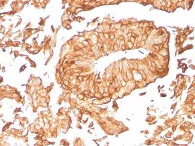 Immunohistochemistry-Paraffin: Uroplakin Ib Antibody (UPK1B/3081) - Azide and BSA Free [NBP2-79933]