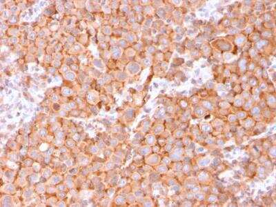 Immunohistochemistry-Paraffin: Uroplakin Ib Antibody (UPK1B/3081) - Azide and BSA Free [NBP2-79933]