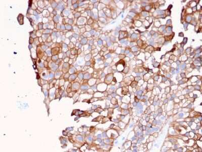 Immunohistochemistry-Paraffin: Uroplakin Ib Antibody (UPK1B/3081) [NBP2-79799]