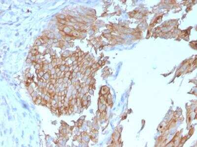 Immunohistochemistry-Paraffin: Uroplakin Ib Antibody (UPK1B/3102) - Azide and BSA Free [NBP2-79934]
