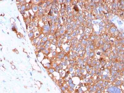 Immunohistochemistry-Paraffin: Uroplakin Ib Antibody (UPK1B/3102) - Azide and BSA Free [NBP2-79934]