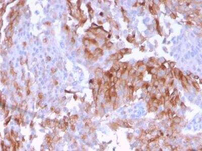 Immunohistochemistry-Paraffin: Uroplakin Ib Antibody (UPK1B/3102) - Azide and BSA Free [NBP2-79934]