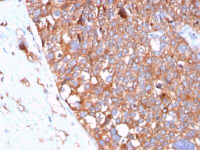 Immunohistochemistry-Paraffin: Uroplakin Ib Antibody (UPK1B/3102) [NBP2-79800]