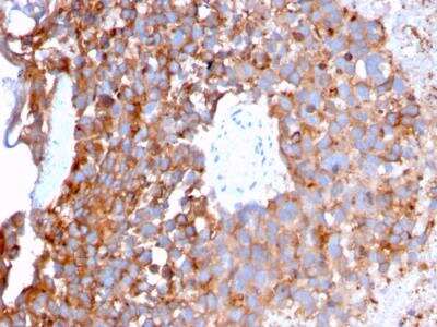 Immunohistochemistry-Paraffin: Uroplakin Ib Antibody (UPK1B/3273) - Azide and BSA Free [NBP2-79935]