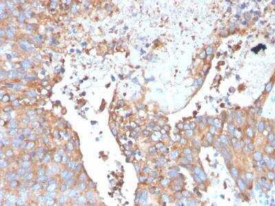 Immunohistochemistry-Paraffin: Uroplakin Ib Antibody (UPK1B/3273) - Azide and BSA Free [NBP2-79935]