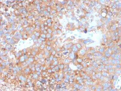 Immunohistochemistry-Paraffin: Uroplakin Ib Antibody (UPK1B/3273) - Azide and BSA Free [NBP2-79935]