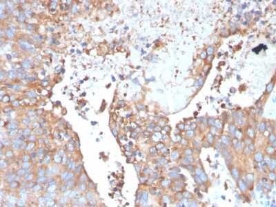 Immunohistochemistry-Paraffin: Uroplakin Ib Antibody (UPK1B/3273) [NBP2-79801]