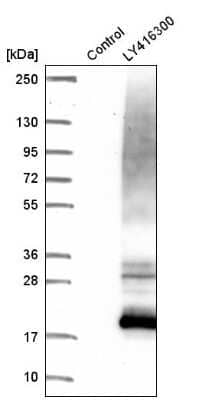Western Blot: Uroplakin Ib Antibody [NBP1-80656]