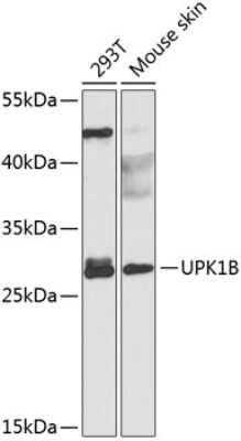 Western Blot: Uroplakin Ib AntibodyBSA Free [NBP2-93853]